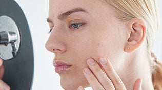 How To Get Rid Of Acne?