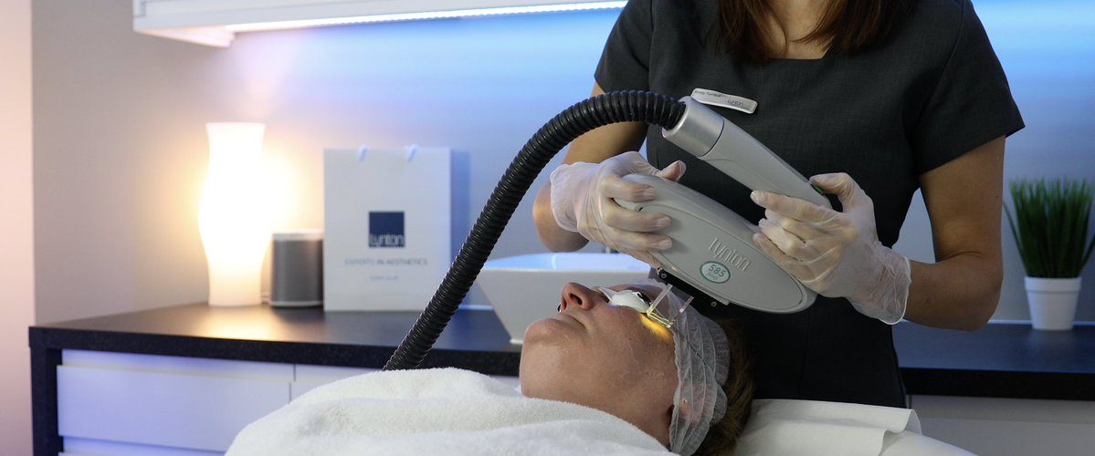 585 IPL facial treatment at The Lynton Clinic