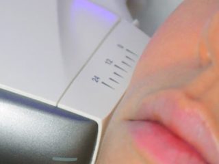HIFU Handpiece on Woman Cheek - Lynton Focus Dual