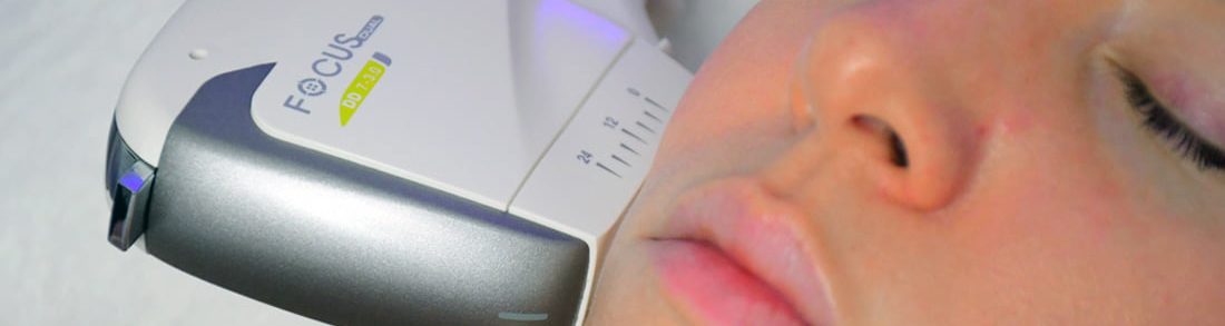 HIFU Handpiece on Woman Cheek - Lynton Focus Dual