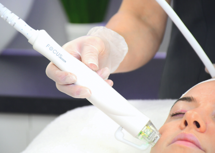 Focus Dual Microneedle Radiofrequency Treatment on Woman's Face