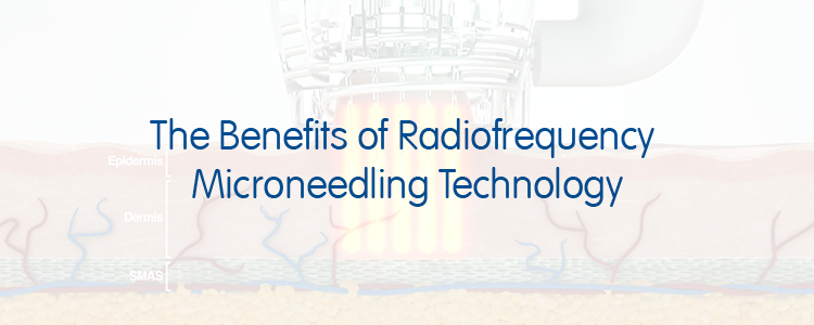 The Benefits of Radiofrequency Microneedling Technology