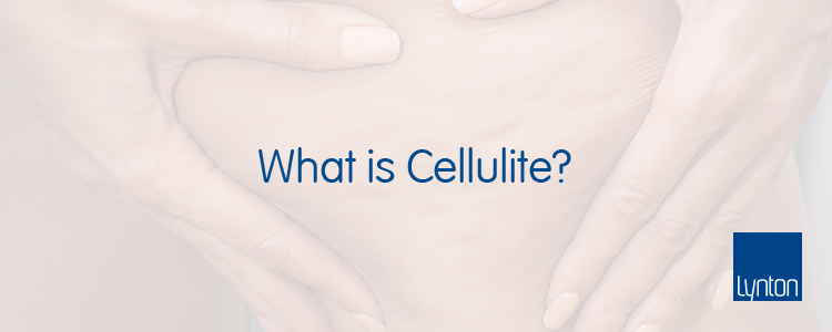 What is Cellulite Blog