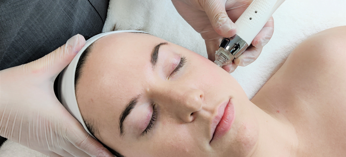 Best Microneedling Pen and Training - Micro Needling Professional