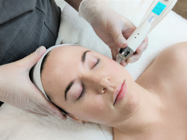 Mesotherapy VS Microneedling