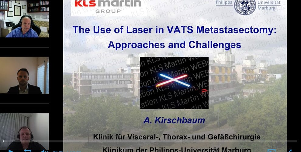 laser in VATS metastasectomy