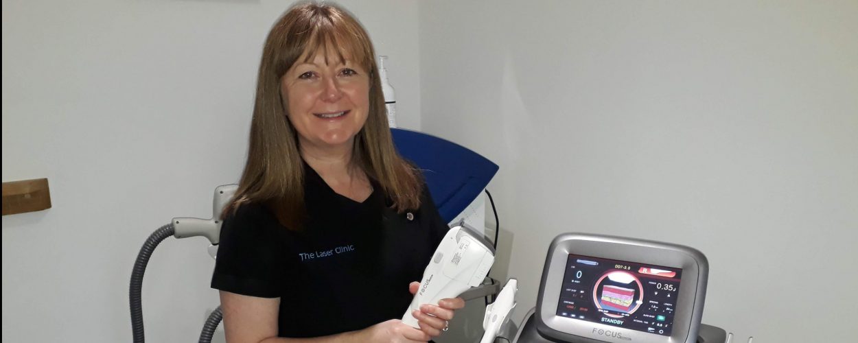 Susan of the Laser Clinic Morpeth - Focus Dual® Success Story