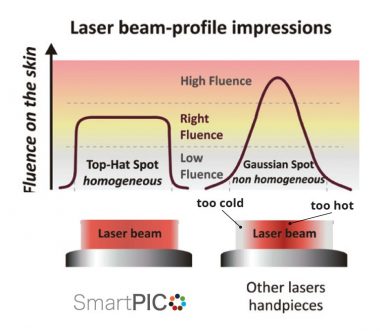 SmartPICO Laser Beam